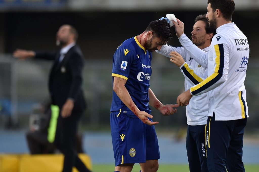 Hellas Verona v Udinese Calcio - Serie A